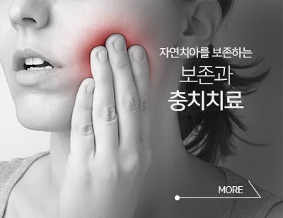 충치치료
