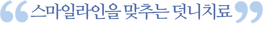 스마일라인을 맞추는 덧니치료